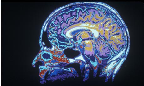 5 اکتشاف برتر عصب شناسی در سال 2014